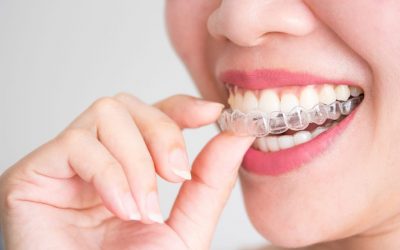 Your Personal Invisalign Journey!