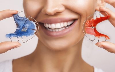 My Retainer Isn’t Fitting, What do I do?