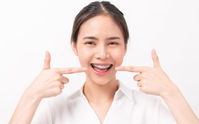 How long will my braces be on?