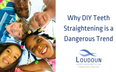 Why DIY Teeth Straightening Is a Dangerous Trend!
