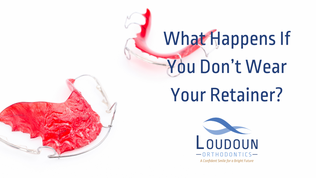 What Happens If You Don't Wear Your Retainer?