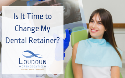 Is It Time to Change My Dental Retainer?