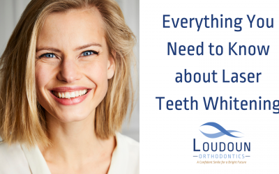 Everything You Need to Know about Laser Teeth Whitening