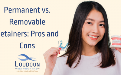 Permanent vs. Removable Retainers: Pros and Cons