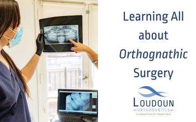 Learning All about Orthognathic Surgery