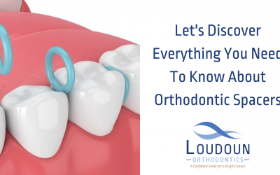 Everything You Need to Know About Orthodontic Spacers!