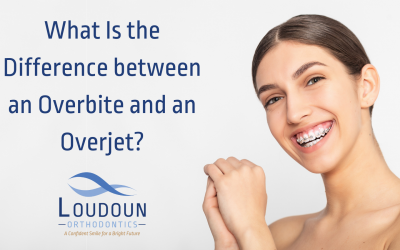 What Is the Difference between an Overbite and an Overjet?