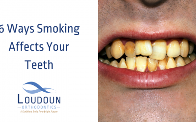 Six Ways Smoking Teeth Damage Happens
