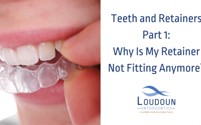 Why Is My Retainer Not Fitting Anymore?