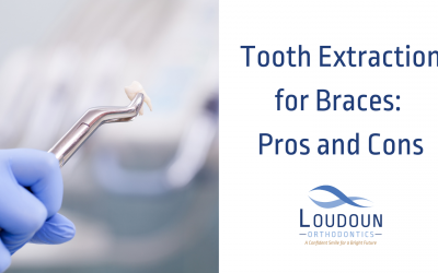Tooth Extraction for Braces: Pros and Cons