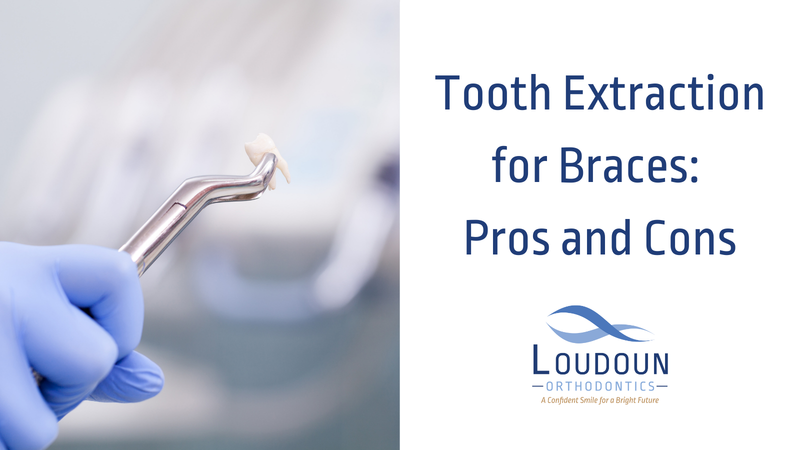 Tooth Extraction for Braces: Pros and Cons