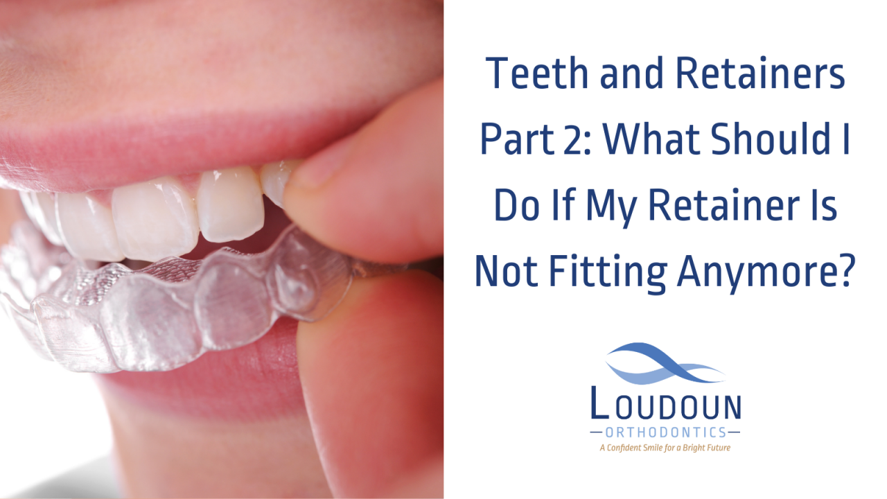 What Should I Do If My Retainer Is Not Fitting Anymore?
