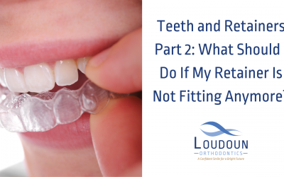 What Should I Do if My Retainer Is Not Fitting Anymore?