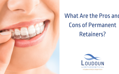 What Are the Pros and Cons of Permanent Retainers?