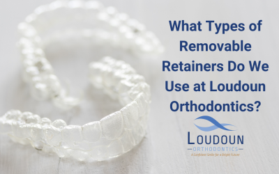 What Types of Removable Retainers Do We Use at Loudoun Orthodontics?