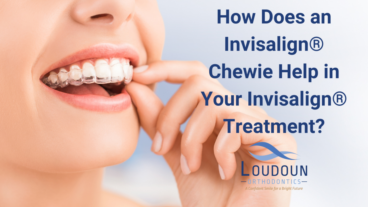 How Do Invisalign Chewies Help Your Orthodontic Treatment?