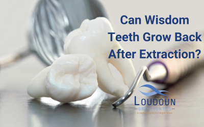 Can Wisdom Teeth Grow Back after Extraction?