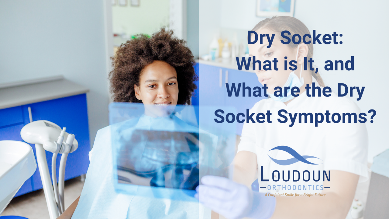 What is a Dry Socket and What are Its Symptoms?