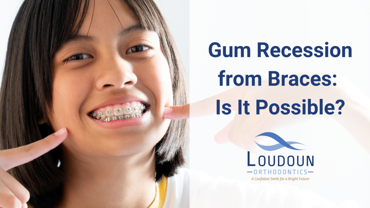 Gum Recession From Braces Is It Possible?