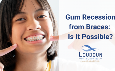 Gum Recession From Braces: Is It Possible?