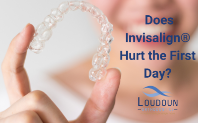 Does Invisalign Hurt the First Day?