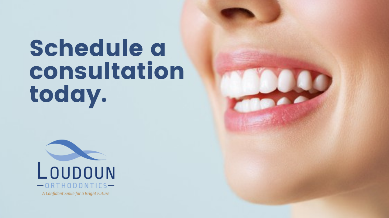 How Do Invisalign Bite Ramps Work on Aligners? | Loudoun Orthodontics