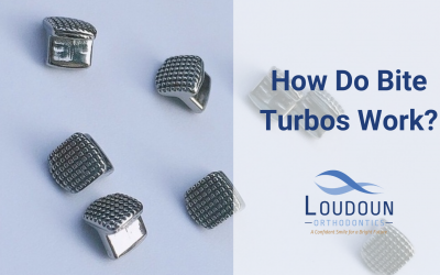 How Do Bite Turbos Work?