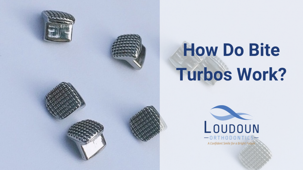 How Do Bite Turbos Work? Loudoun Orthodontics