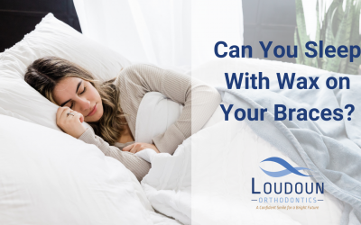 Can You Sleep With Wax On Your Braces?