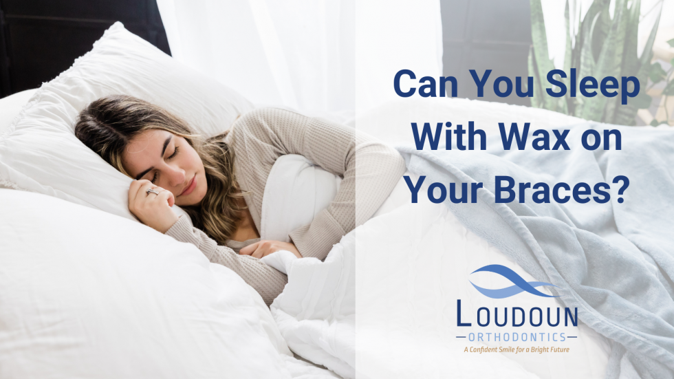 Can You Sleep With Wax On Your Braces 