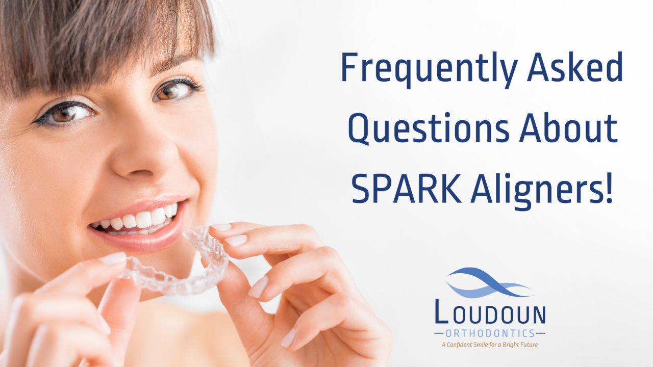 Frequently Asked Questions About SPARK Aligners!