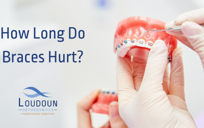 How Long Do Braces Hurt?