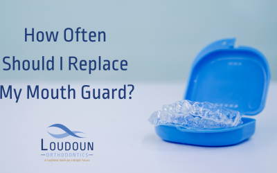 How Often Should I Replace My Mouth Guard?
