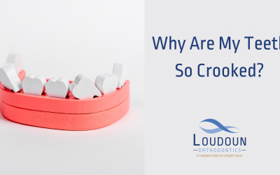 Why are My Teeth So Crooked?