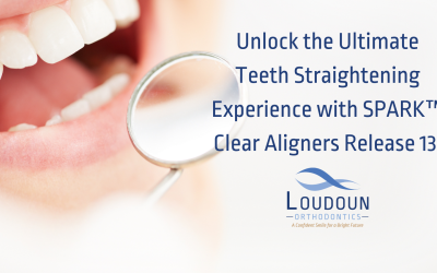 Unlock the Ultimate Teeth Straightening Experience With SPARK Clear Aligners Release 13!