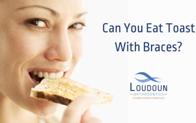 Can You Eat Toast With Braces?