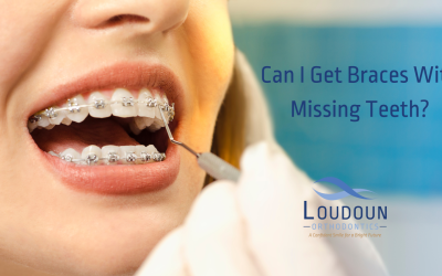 Can I Get Braces With Missing Teeth?