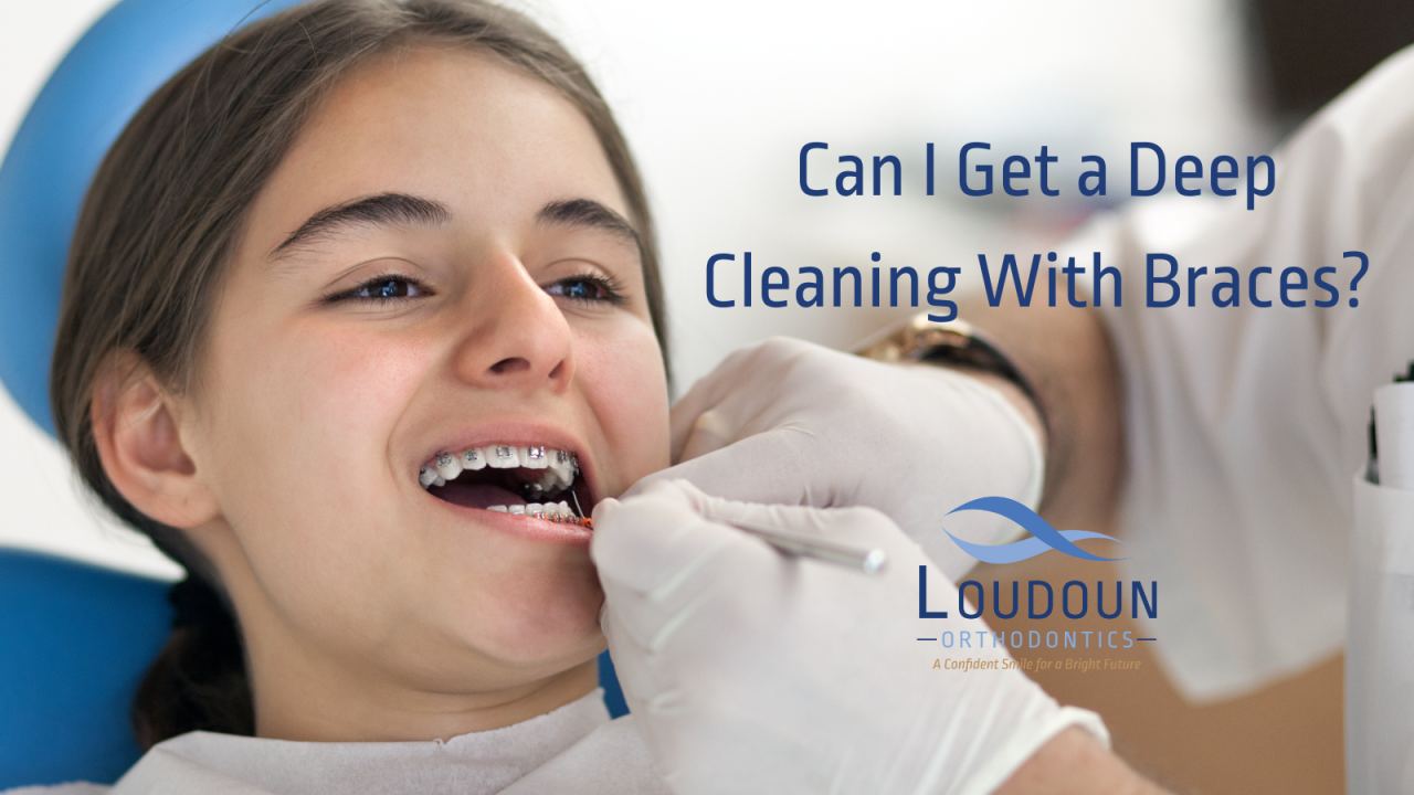 Can I Get a Deep Cleaning With Braces?
