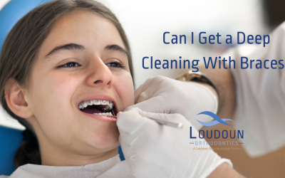 Can I Get a Deep Cleaning With Braces?