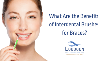 What are the Benefits of Interdental Brushes for Braces?