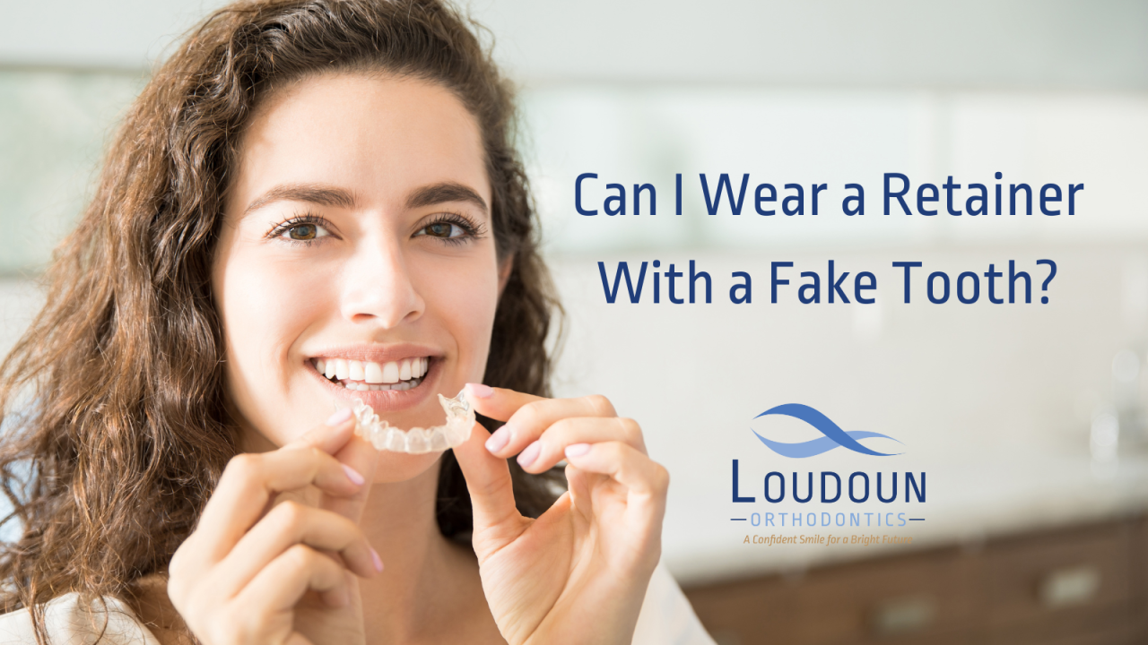 Can I Wear a Retainer With a Fake Tooth?