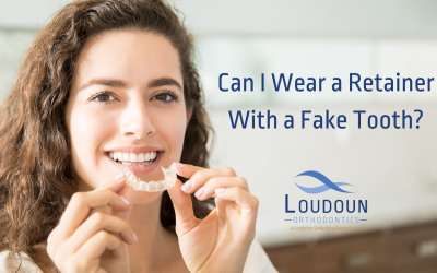 Can I Wear a Retainer With a Fake Tooth?