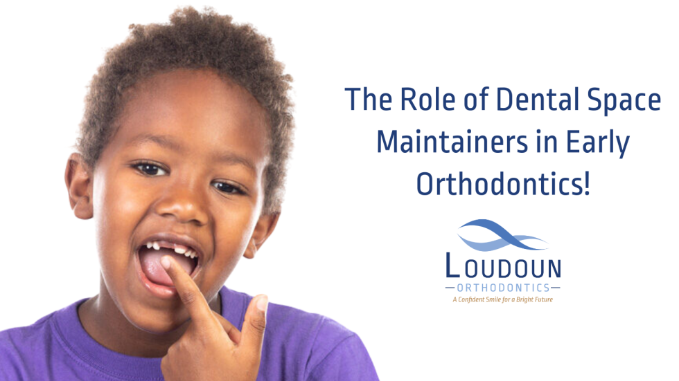 The Role of Dental Space Maintainers in Early Orthodontics!