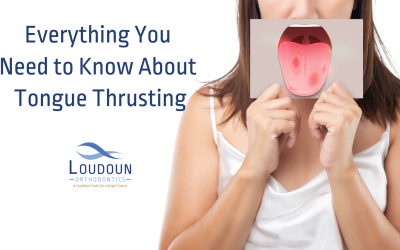 Everything You Need to Know About Tongue Thrusting