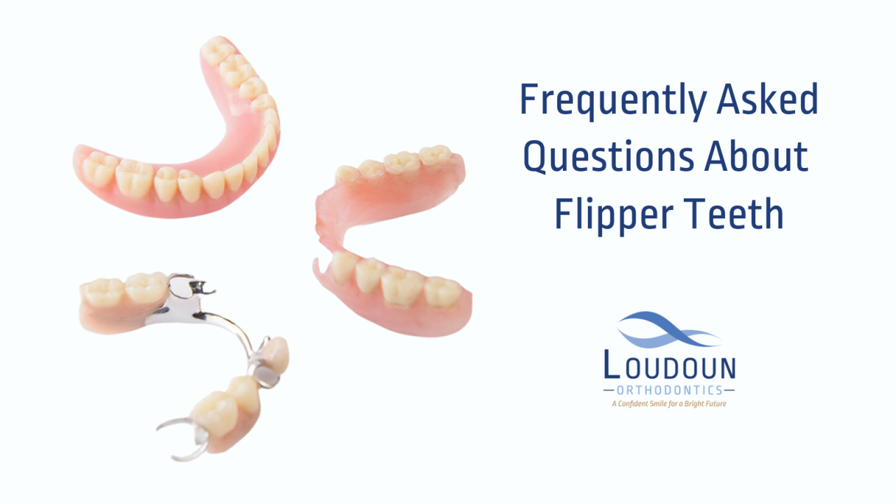 Frequently Asked Questions About Flipper Teeth!