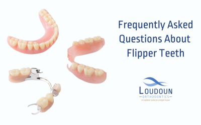 Frequently Asked Questions About Flipper Teeth!