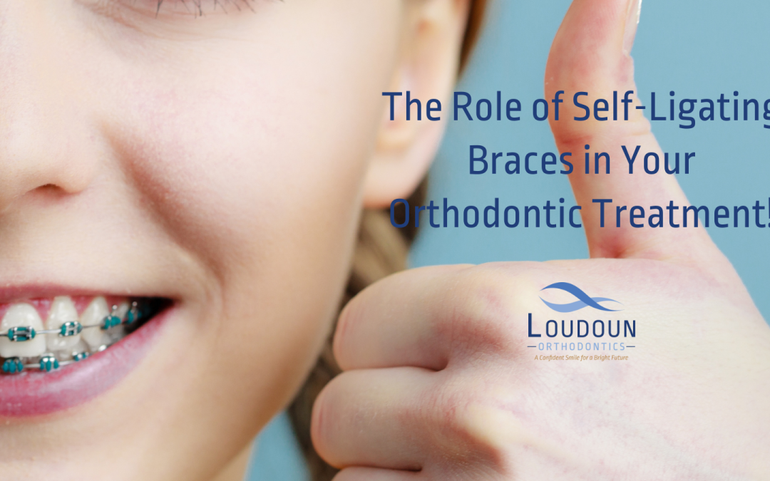 The Role of Self-Ligating Braces in Your Orthodontic Treatment!