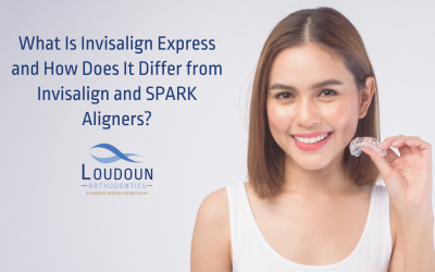 What Is Invisalign Express and How Does It Differ from Invisalign and SPARK Aligners?