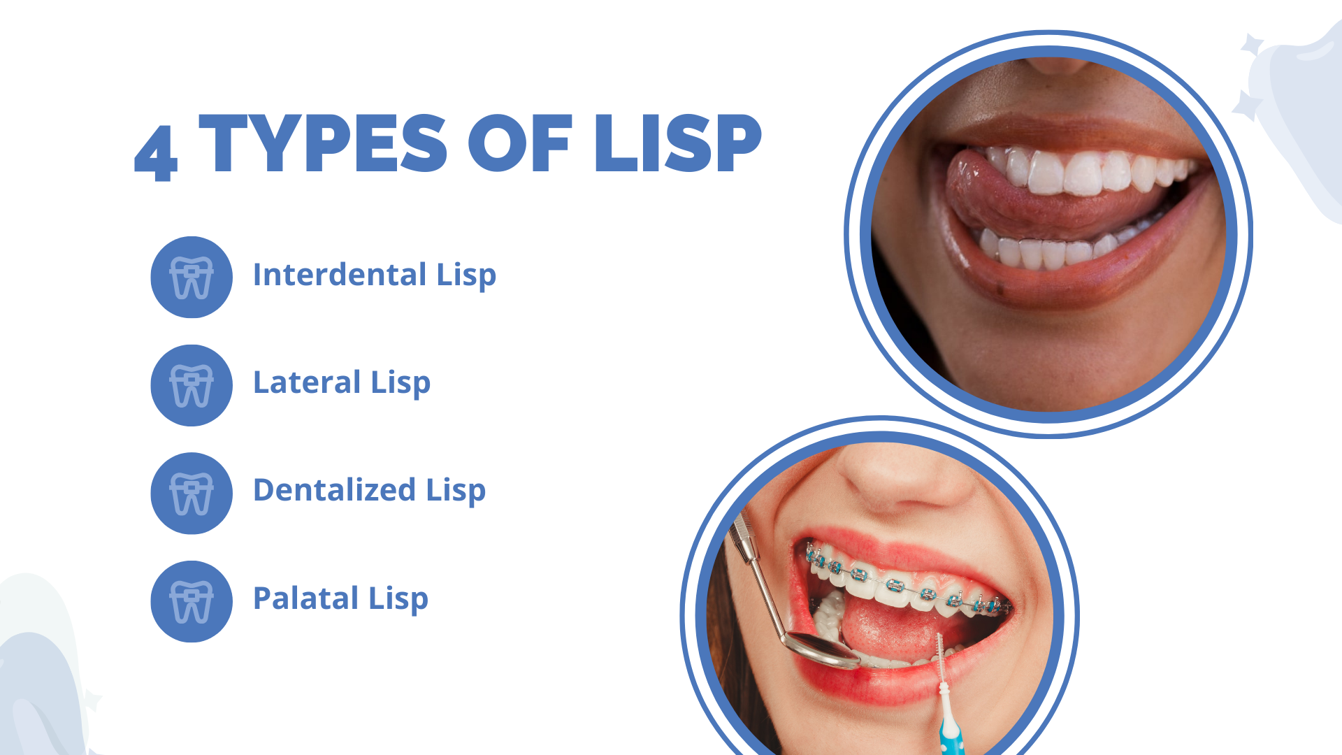 Can Braces Give You A Lisp 