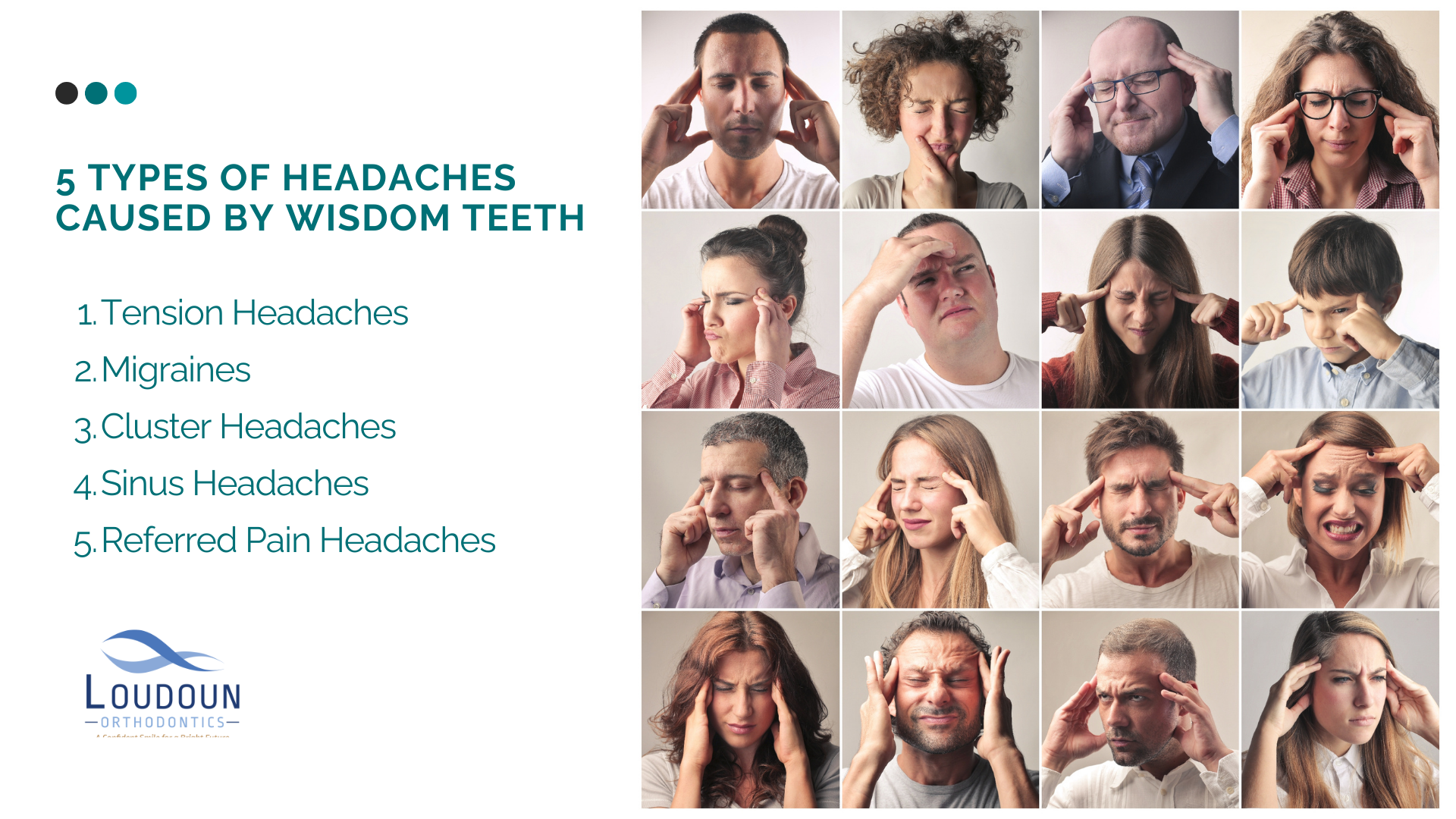 Types of Headaches Caused by Wisdom Teeth